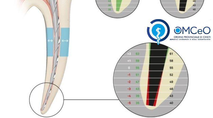 Clicca per accedere all'articolo " L'Endodonzia oggi, le nuove prospettive "